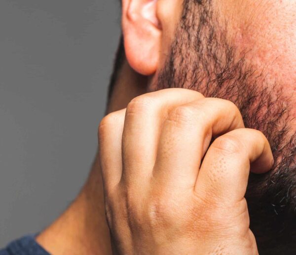 barbe gratte